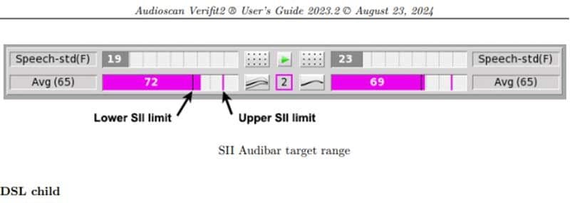 speech-intelligibility-index_0.jpeg
