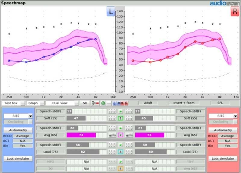 speech-intelligibility-index_0.jpeg
