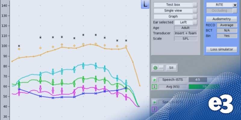speech-intelligibility-index_thumbnail.jpeg