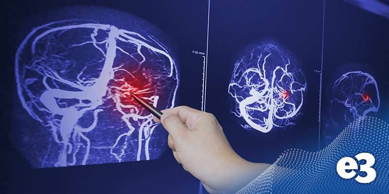 traumatic-brain-injury_thumbnail.jpeg