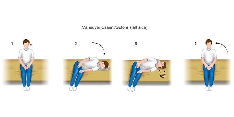 Horizontal Canal BPPV: Diagnosis and Treatment | e3 Diagnostics